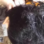 VIRAL VIDEO: Warning: Unpleasant Video Of A Child's Headlice Infestation That Can Shock Netizens
